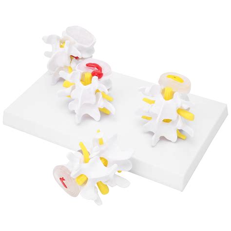 Buy Spine Model, Combination Spine Model Four-Stage Vertebrae ...