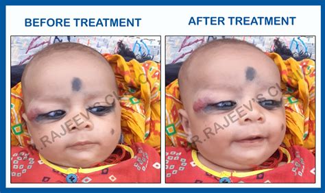 Our Treatment Result | Rajeevclinic.com