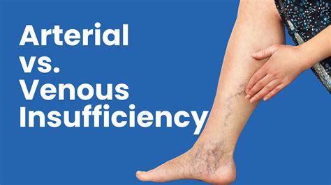 Arterial vs Venous Insufficiency | Key Differences & Symptoms