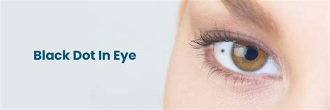 Puntos negros en el ojo: causas y soluciones