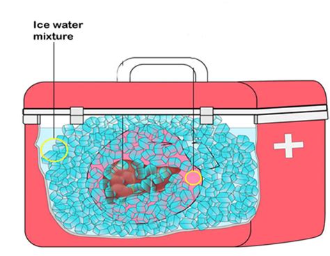 Medical Applications Using Arduino 的图像结果