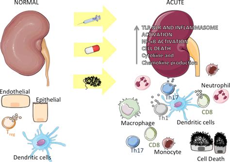 Renal Parenchymal Disease
