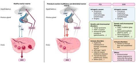 Premature Ovarian Insufficiency and Diminished Ovarian Reserve: From Diagnosis to Current ...