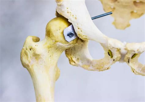 股骨骨头结构 向量例证. 插画 包括有 软骨, 长期, 详细资料, 骨髓, 爱好健美者, 关心, 图象 - 109718573