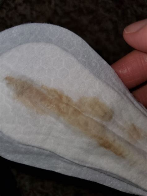 11 dpo discharge or spotting or implantation bleeding? - Glow Community