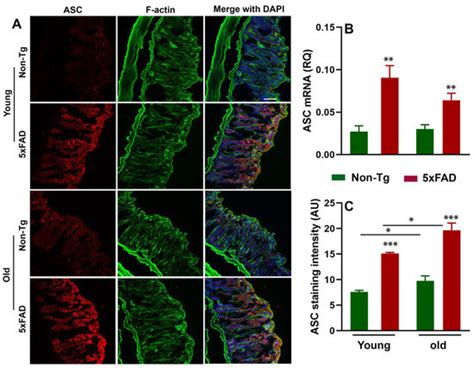 Alterations in the Gut-Microbial-Inflammasome-Brain Axis in a Mouse ...