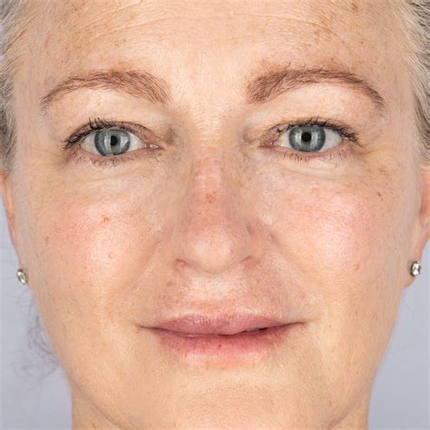 LED Face Mask | Red Light Therapy Masks | CurrentBody India