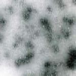Crop Protection >> Diseases >> Grassy Stunt & Ragged Stunt Virus