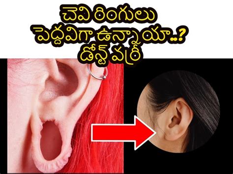 చెవి పోగు రంధ్రాలు పెద్దవిగా ఉన్నాయా.. డోన్ట్ వర్రీ ఈ చిట్కాలు ఫాలో ...
