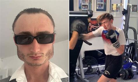 Boxer who has spent years bare-knuckle fighting has developed a square ...