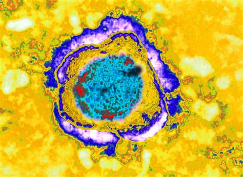 The lethal beauty of viruses and bacteria
