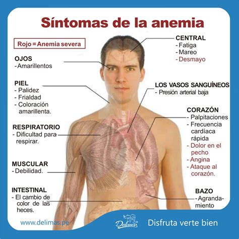 Sintomas De Anemia