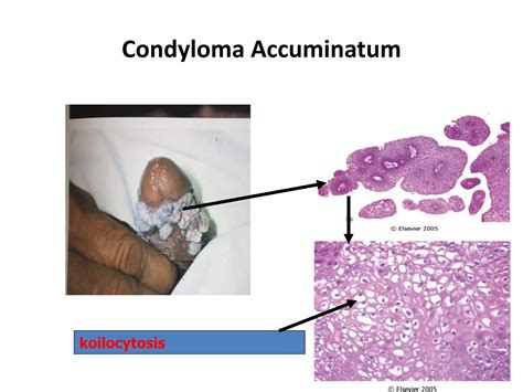 Male genital part i | PPTX