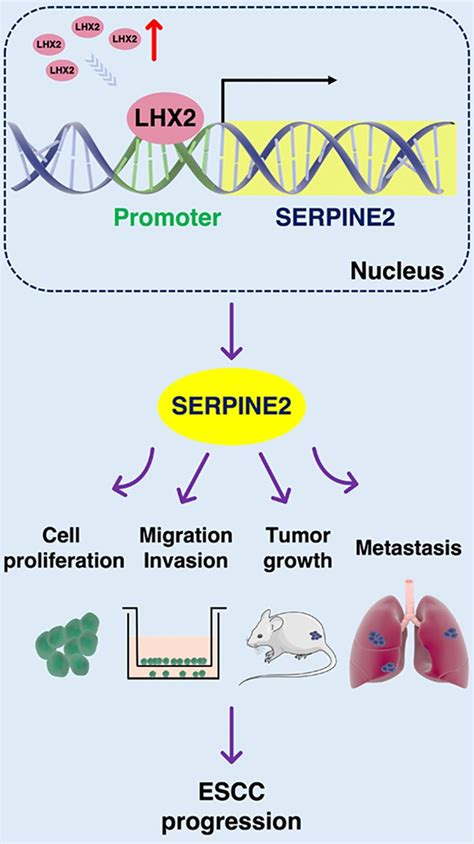 LHX2 Enhances the Malignant Phenotype of Esophageal Squamous Cell ...