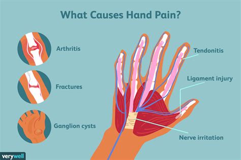 Causes Of Sore Wrist