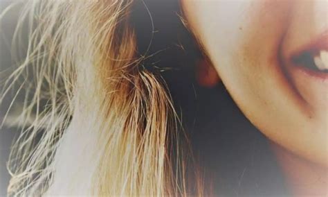 Injectable PLLA-SCA treatments effective for correction of cheek wrinkles