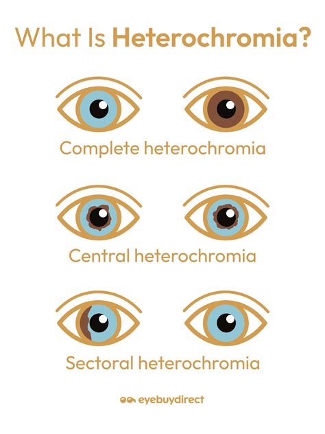 Heterochromia Iridis