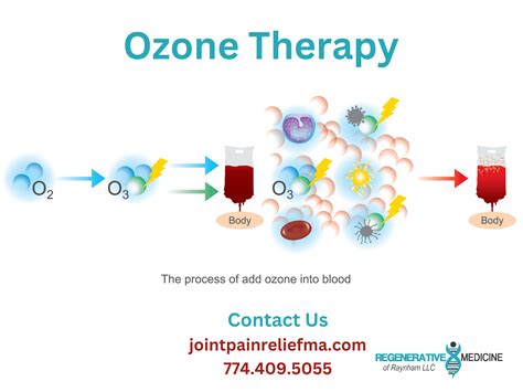 Ozone therapy healing with advanced techniques – Artofit