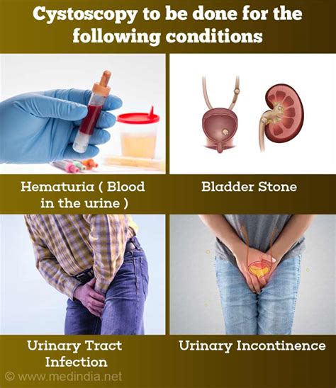 Image result for Cystoscopy Procedure