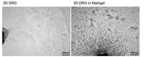 Image result for Basic 2D DRG