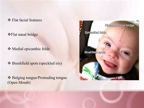 Down syndrome awareness | PPTX