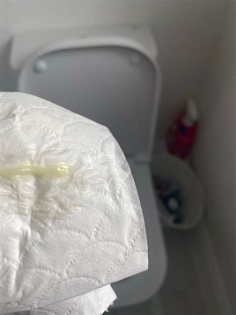 Yellowish Green Discharge