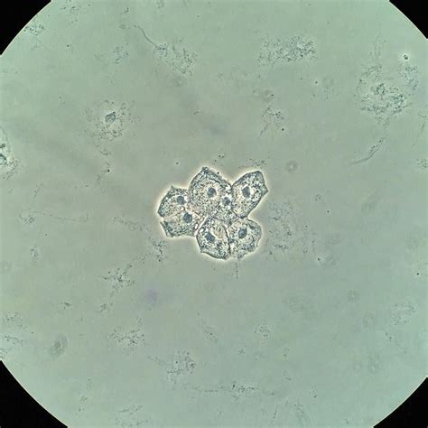 What Are Squamous Epithelial Cells In Urine at Ruby Silverman blog