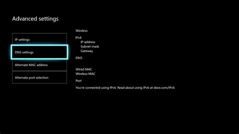 Best Xbox DNS Settings To Use For Gaming