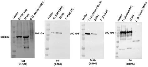 Genomic Dissection of an Enteroaggregative Escherichia coli Strain Isolated from Bacteremia ...