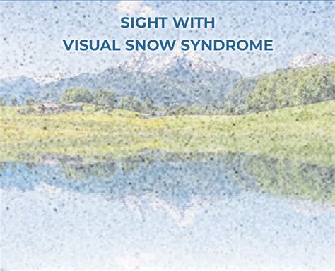 Image result for Visual Snow Simulator