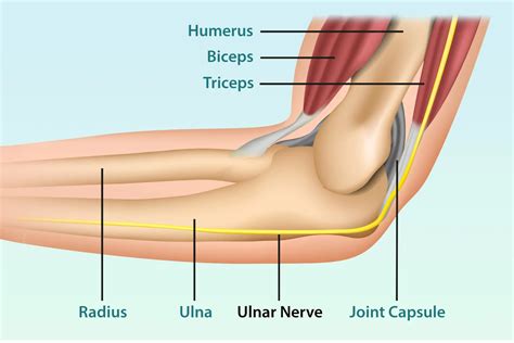 Cubital Tunnel Syndrome: Symptoms, Causes & Treatment Options