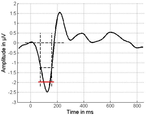 Can Mismatch Negativity Be Used as an Indicator to Predict Central ...