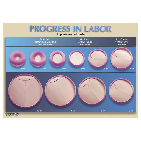 Educational Progress In Labor Chart | Childbirth Graphics