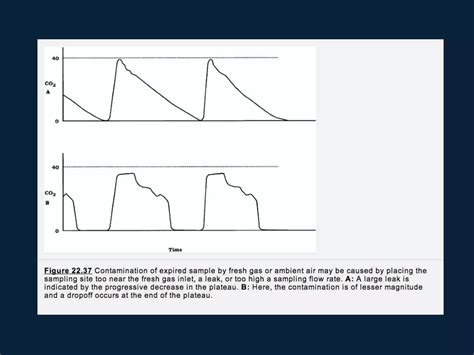 End tidal co2 and transcutaneous monitoring | PPTX