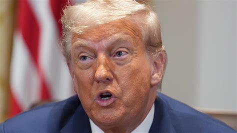 President Donald Trump diagnosed with chronic venous insufficiency ...