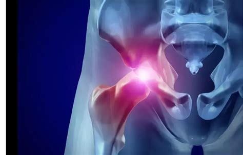 Novel "Screw First" Technique to Get Past Nail-Jig Mismatch in Proximal ...