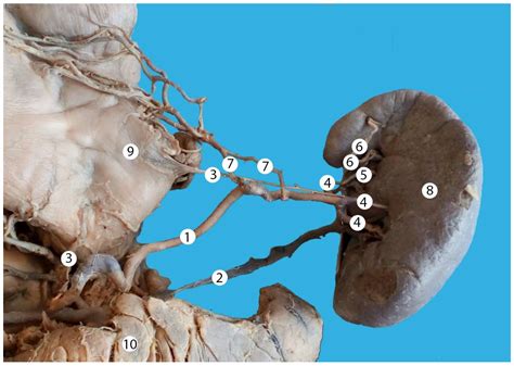 Morphological Evaluation of the Splenic Artery, Its Anatomical ...