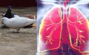 कबूतरों को दाना डालना बन सकता है जानलेवा! डॉक्टर ने बताया होती है ...