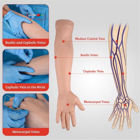 What Are The Most Commonly Used Veins For Venipuncture at Daniel ...