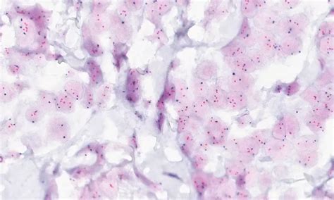 Philips - Pathology Scanner Second Generation SG300 - Philips