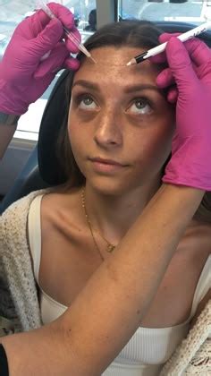 Image result for Botox Injection Guide