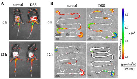 Construction of Chitosan/Alginate Nano-Drug Delivery System for ...