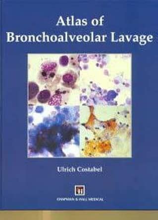 Buy Atlas of Bronchoalveolar Lavage Book Online at Low Prices in India ...