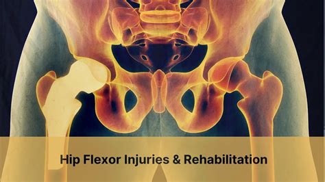 Hip Flexor Injuries & Rehabilitation | PhysioChoice Blog