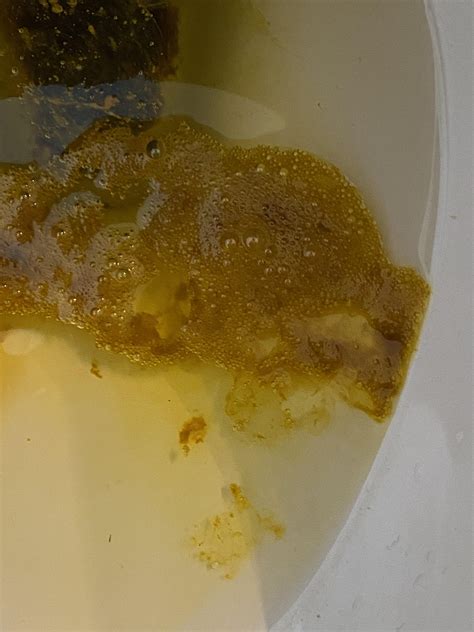 Foamy Poop On Period at Linda Redmon blog