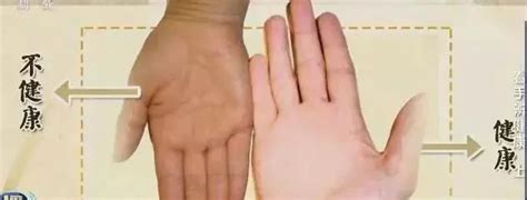 神秘的手印具有非凡的疗愈力量_拇指