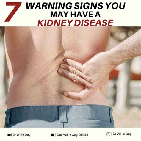 Signs Kidney Disease at Evelyn Ayala blog
