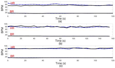 Respiration and Heart Rate Monitoring in Smart Homes: An Angular-Free ...