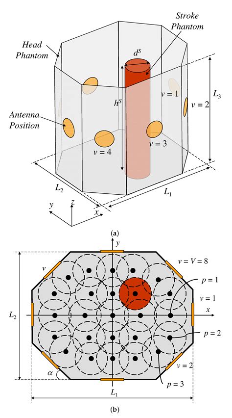 Multi-Step Learning-by-Examples Strategy for Real-Time Brain Stroke ...