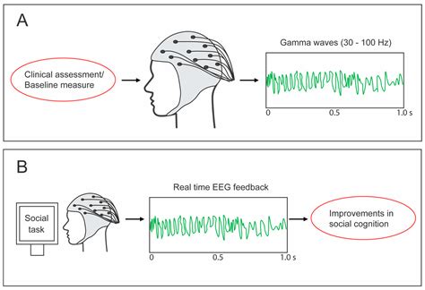 Low-Level Social Demand Is Associated with Anxiety-Related Gamma Wave ...